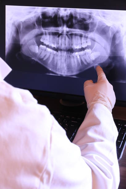 Best Emergency Treatment for Dental Infections or Abscesses in Williamston, NC