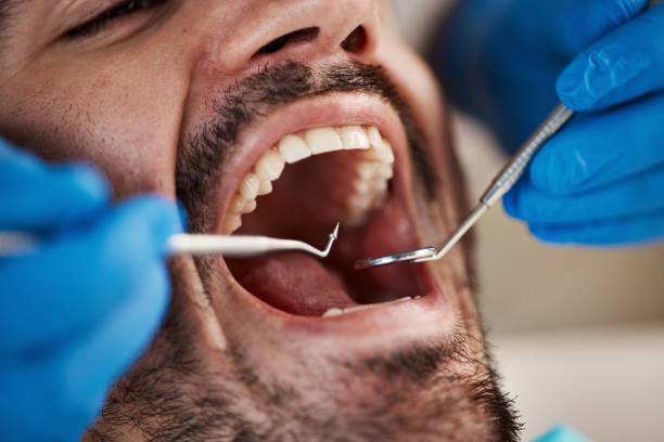 Best Emergency Dental Care for Broken or Chipped Teeth in Williamston, NC